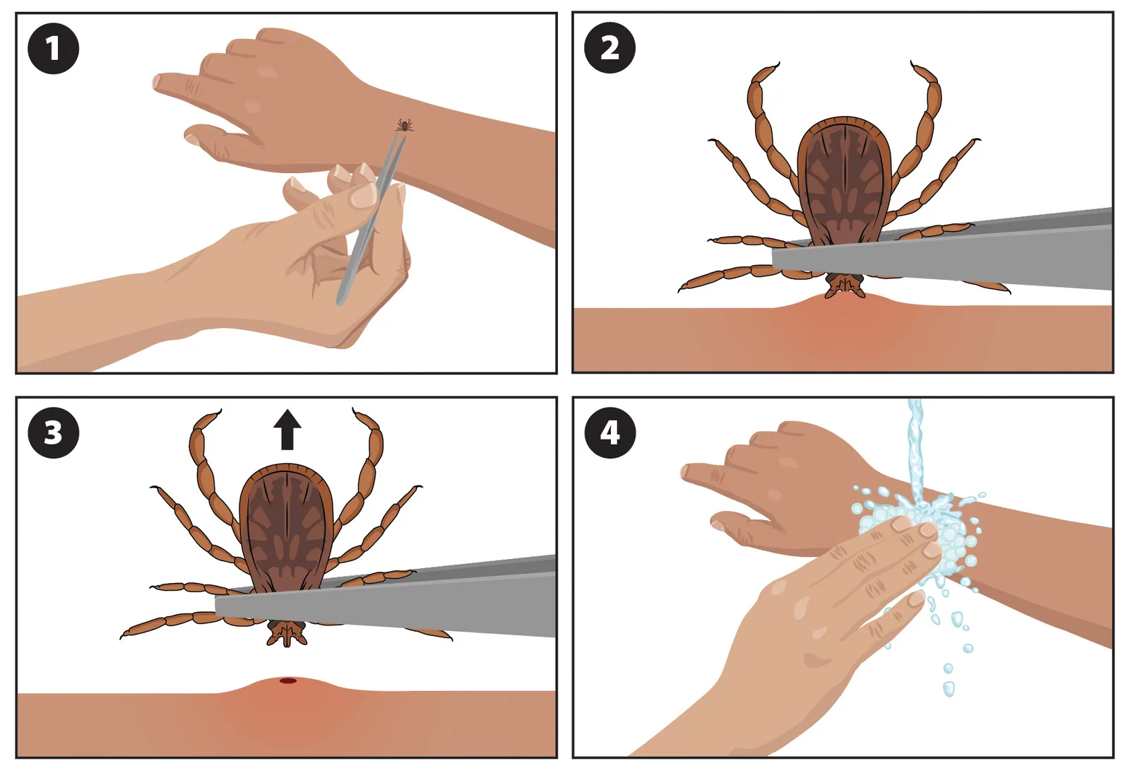Four-panel CDC diagram showing safe tick removal with fine-tipped tweezers
